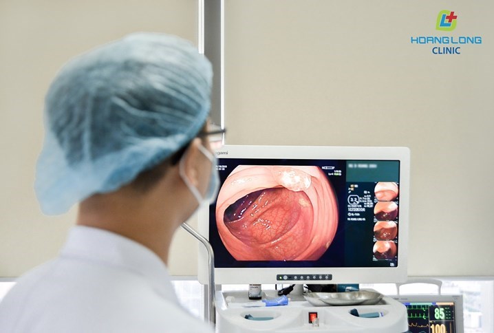 Polyp đại tràng qua hình ảnh nội soi của PK Hoàng Long