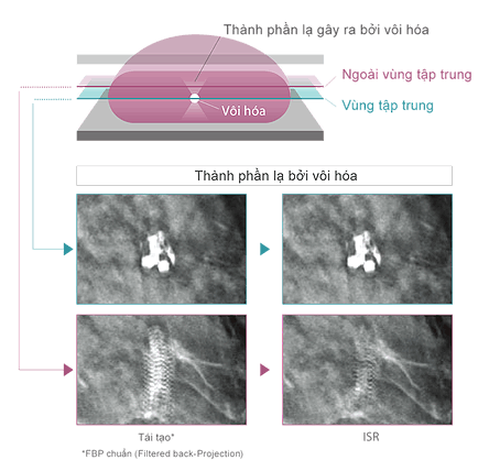 Iterative Super-resolution Reconstruction (ISR) method