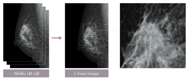 S-View – Synthesized 2D image