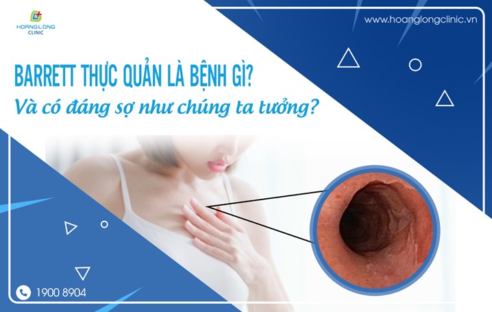 Barrett thực quản là bệnh lý khá phổ biến