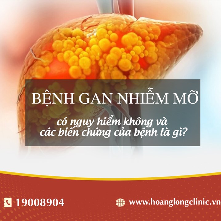 Bệnh gan nhiễm mỡ có nguy hiểm không và các biến chứng của bệnh là gì?