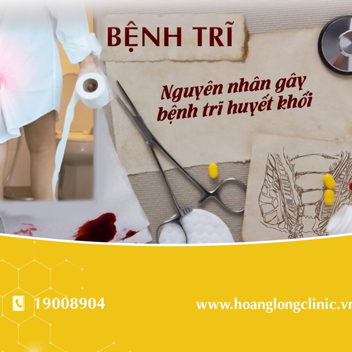 Nguyên nhân gây bệnh trĩ huyết khối