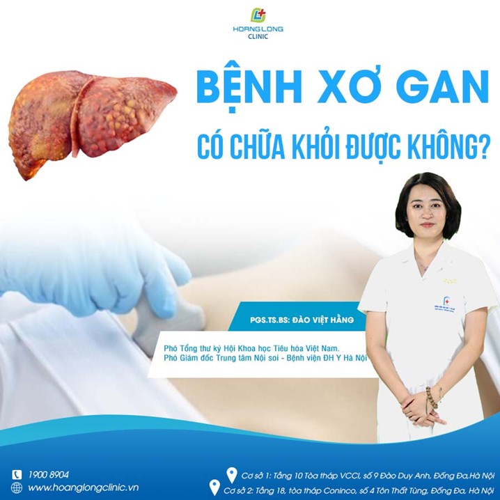 Bệnh xơ gan có chữa được khỏi không?