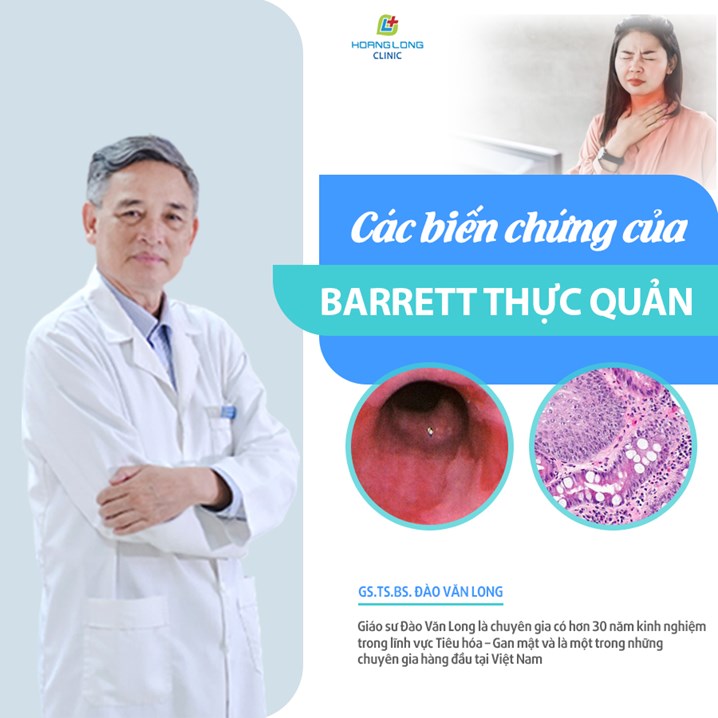Các biến chứng của bệnh Barrett thực quản
