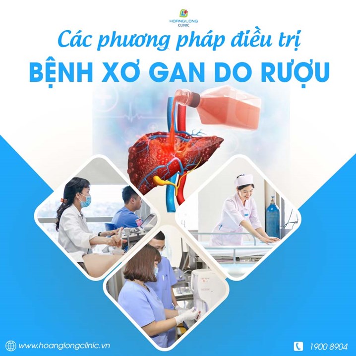 Các phương pháp điều trị bệnh xơ gan do rượu