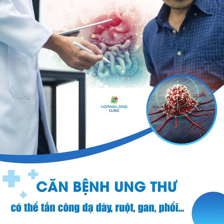 Căn bệnh ung thư có thể tấn công dạ dày, ruột, gan, phổi,...