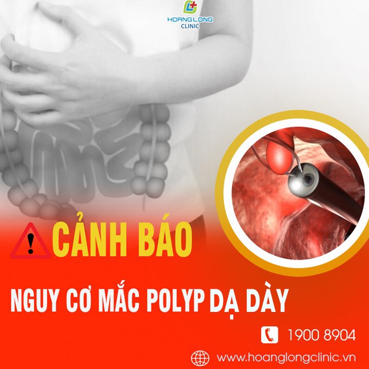 Cảnh báo nguy cơ mắc polyp dạ dày hiện nay