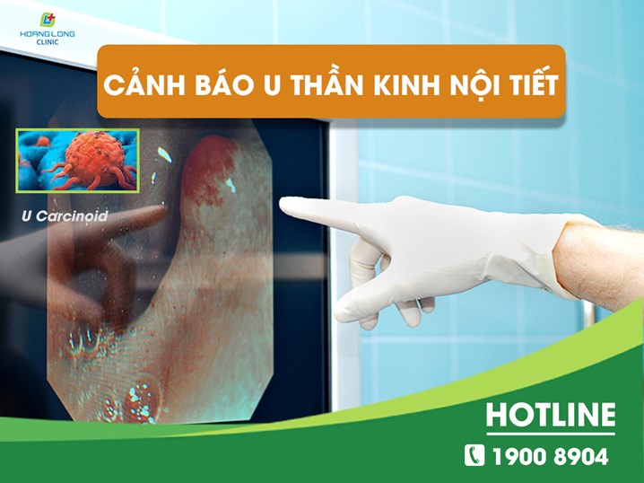 Cảnh báo U thần kinh nội tiết (U Carcinoid) – một loại ung thư đặc biệt nguy hiểm