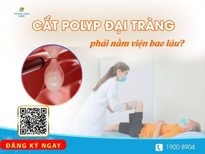 Cắt polyp đại tràng phải nằm viện bao lâu?