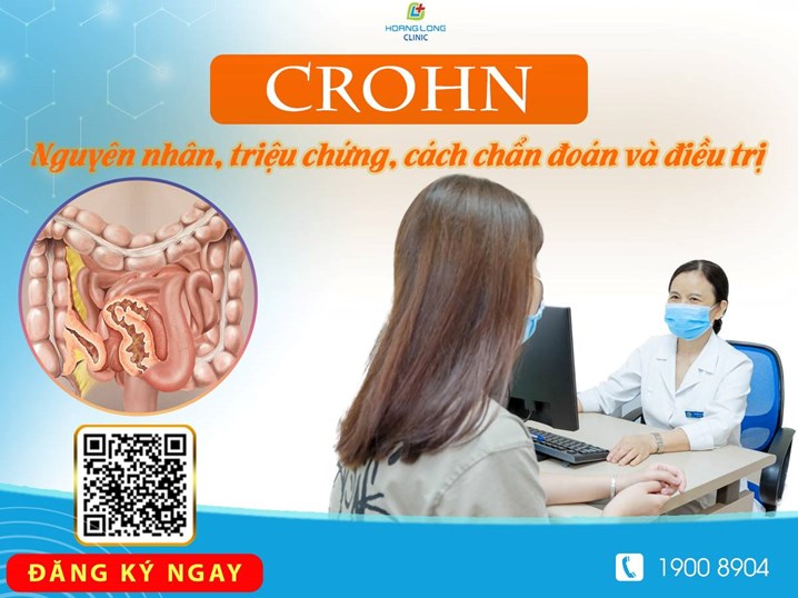 Nguyên nhân, triệu chứng, cách chẩn đoán và điệu trị bệnh Crohn