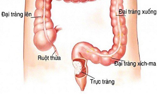 vị trí đại tràng sigma phòng khám đa khoa Hoàng Long