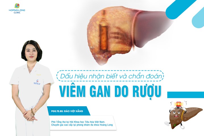 Dấu hiệu nhận biết viêm gan do rượu