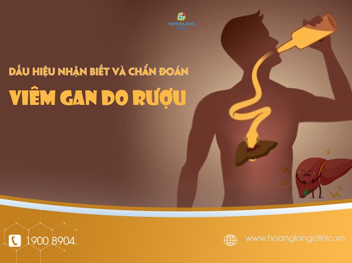 Dấu hiệu nhận biết và chẩn đoán viêm gan do rượu