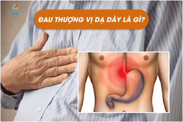 Đau thượng vị dạ dày là gì?