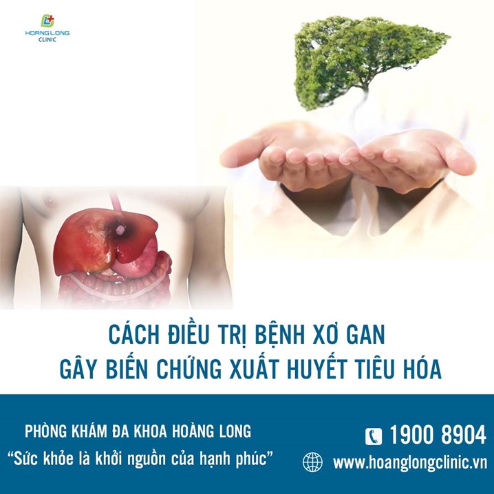 Cách điều trị bệnh xơ gan gây biến chứng xuất huyết tiêu hóa