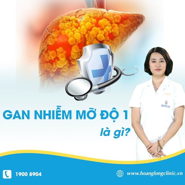 Gan nhiễm mỡ độ 1 là gì?