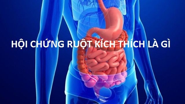 Hội chứng ruột kích thích (ibs), hội chứng ruột kích thích là gì