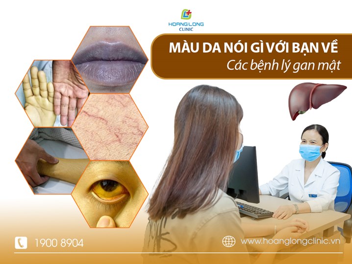 Màu da nói gì với bạn về các bệnh lý gan mật