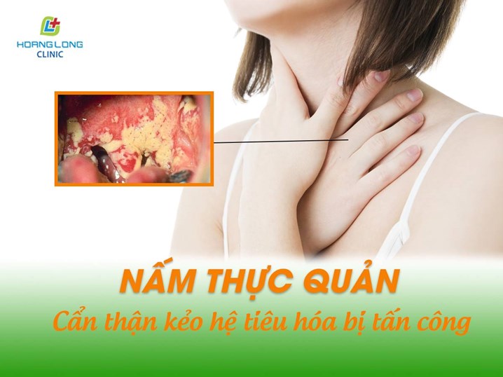 Nấm thự quản cẩn thận kẻo hệ tiêu hóa bị tấn công