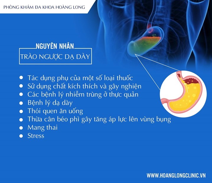 Nguyên nhân gây bệnh trào ngược dạ dày thực quản