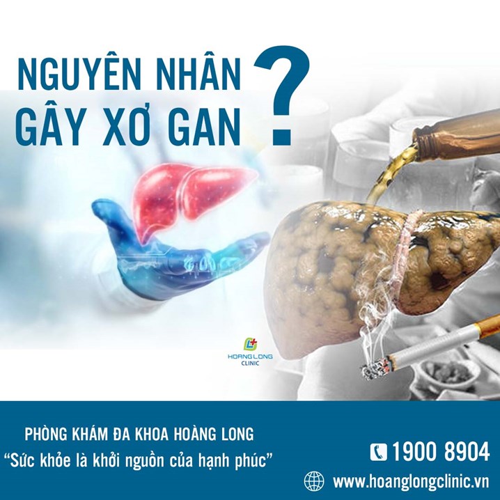 Nguyên nhân gây xơ gan là gì?