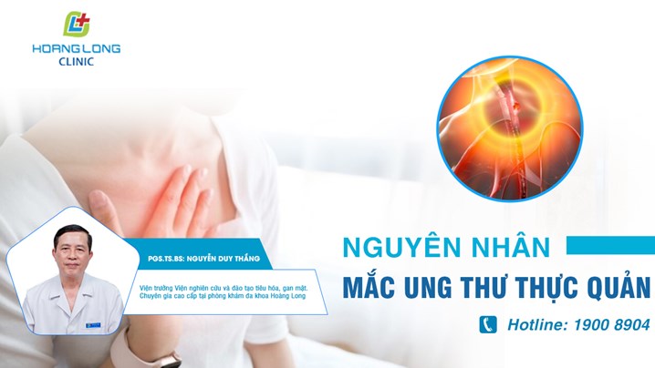 Nguyên nhân mắc ung thư thực quản là gì?