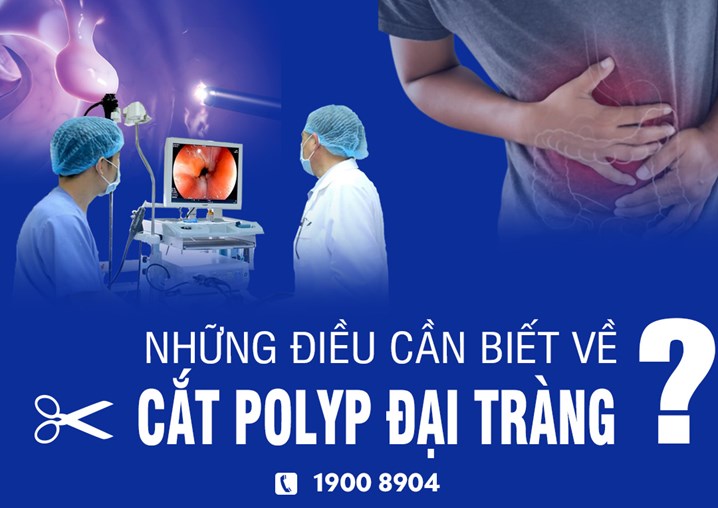 Những điều cần biết về cắt polyp đại tràng là gì?