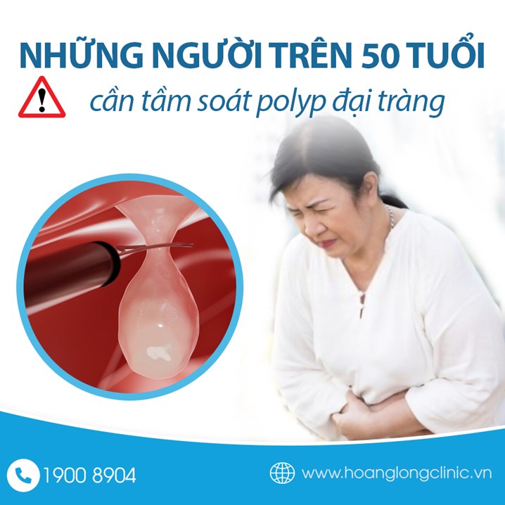 Những người trên 50 tuổi là đối tượng cần tầm soát polyp đại tràng