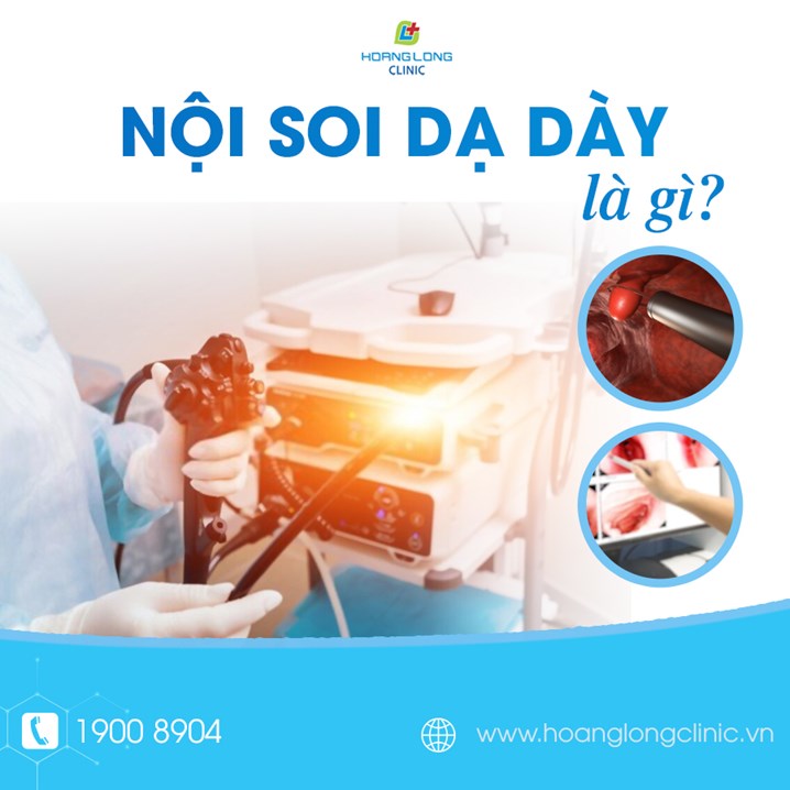 Ảnh minh họa: Nội soi dạ dày là gì?