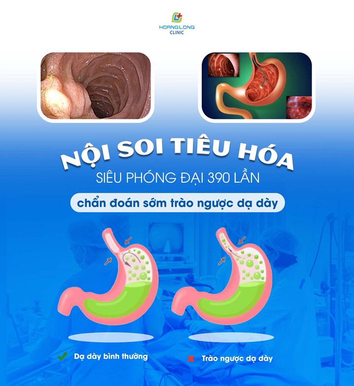 Nội soi tiêu hóa siêu phóng đại tại phòng khám đa khoa Hoàng Long giúp chẩn đoán sớm trào ngược dạ dày