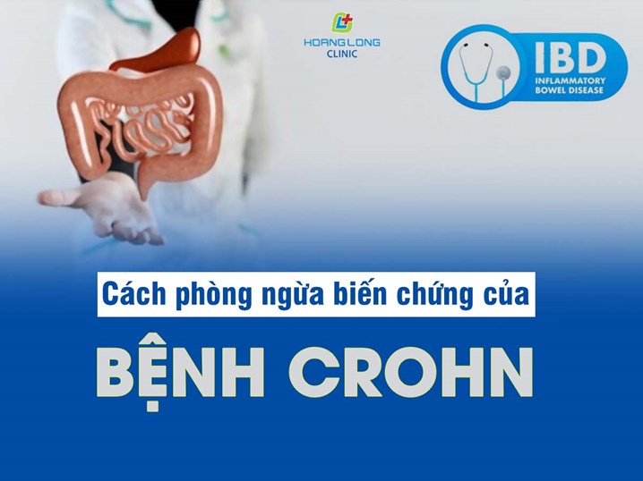 Cách phòng ngừa biến chứng của bệnh Crohn