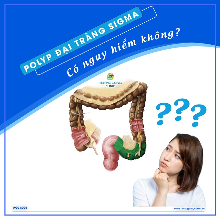 Polyp đại tràng sigma có nguy hiểm không?