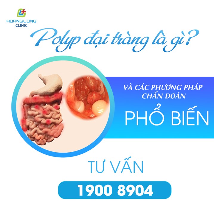 Polyp đại tràng và các phương pháp chẩn đoán phổ biến