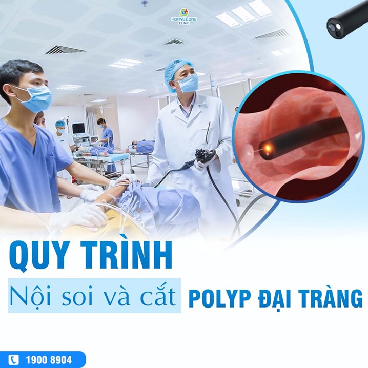 Quy trình nội soi và cắt polyp đại tràng tại phòng khám đa khoa Hoàng Long