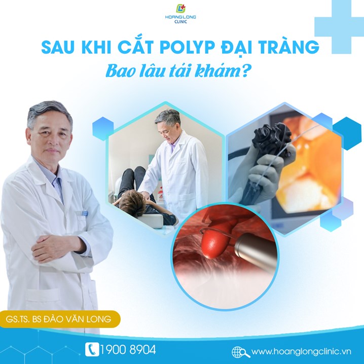 Sau khi cắt polyp đại tràng bao lâu tái khám?