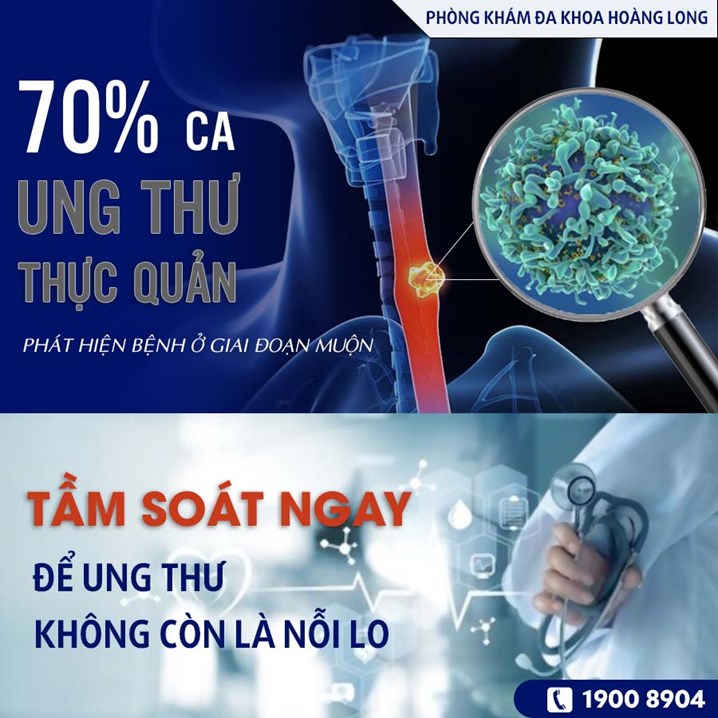 Tầm soát ngay để ung thư thực quản không còn là nỗi lo