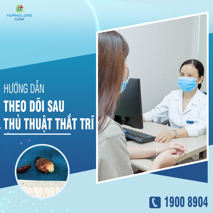 Hướng dẫn theo dõi sau thủ thuật thắt trĩ bằng vòng cao su
