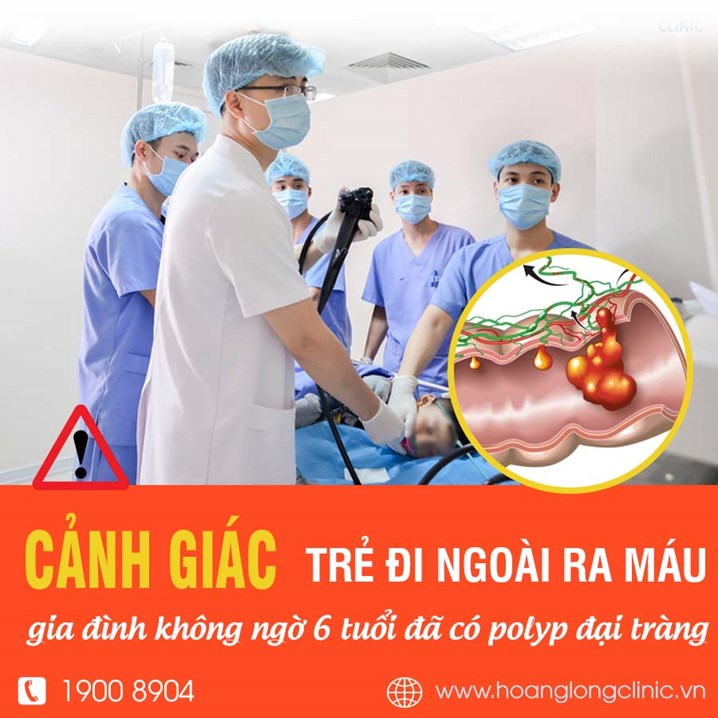 Trẻ đi ngoài ra máu, gia đình không ngờ 6 tuổi đã có polyp đại tràng