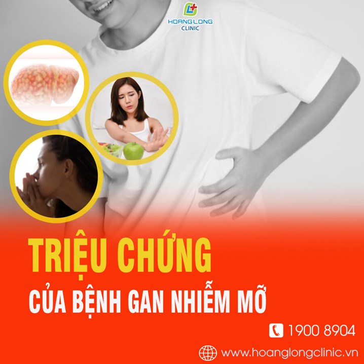 Triệu chứng của bệnh gan nhiễm mỡ