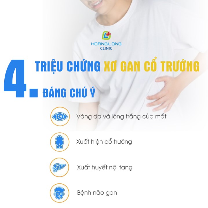 Triệu chứng xơ gan cổ trướng đáng chú ý