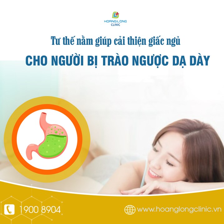 Tư thế nằm ngủ giúp cải thiện giấc ngủ cho người bị trào ngược dạ dày