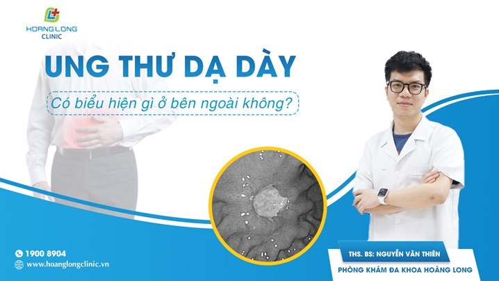 Ung thư dạ dày có biểu hiện gì bên ngoài không?