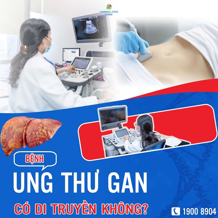 Ung thư gan có di truyền không?