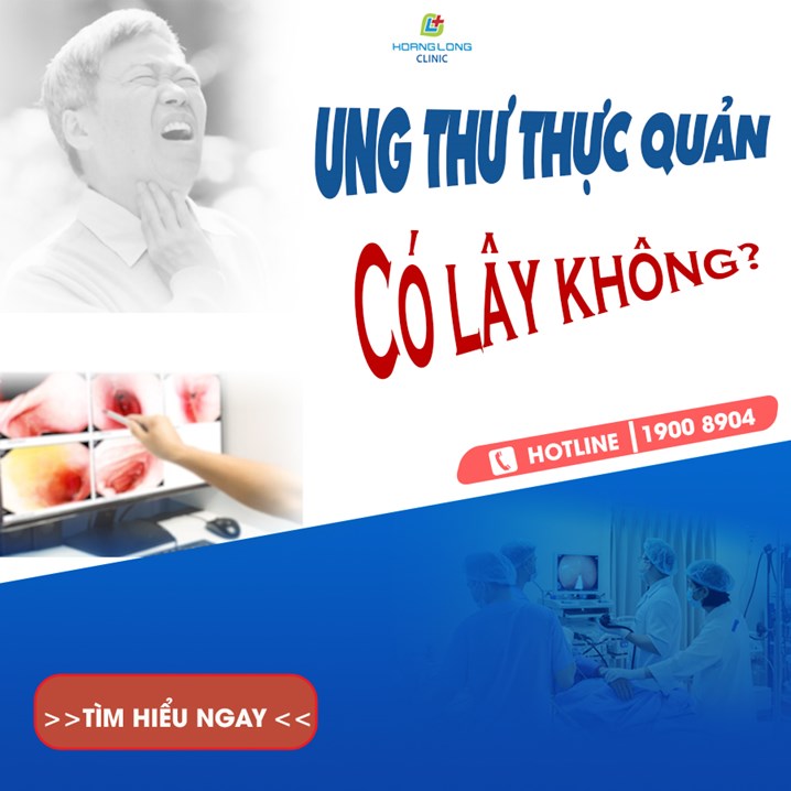 Ung thư thực quản có lây không?