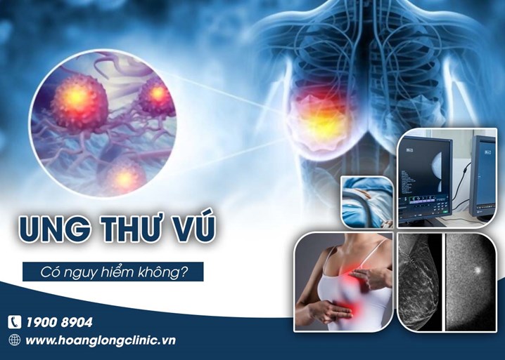 Ảnh minh họa: Ung thư vú có nguy hiểm không?