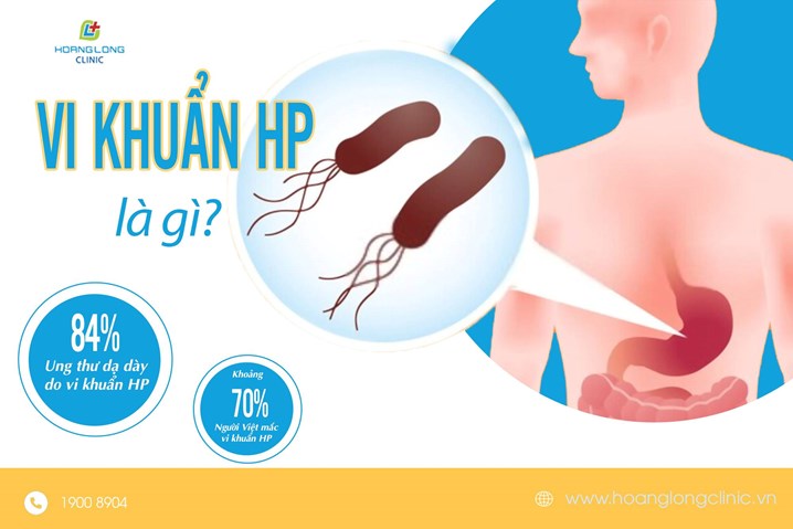 70% dân số Việt Nam nhiễm vi khuẩn HP gây viêm dạ dày