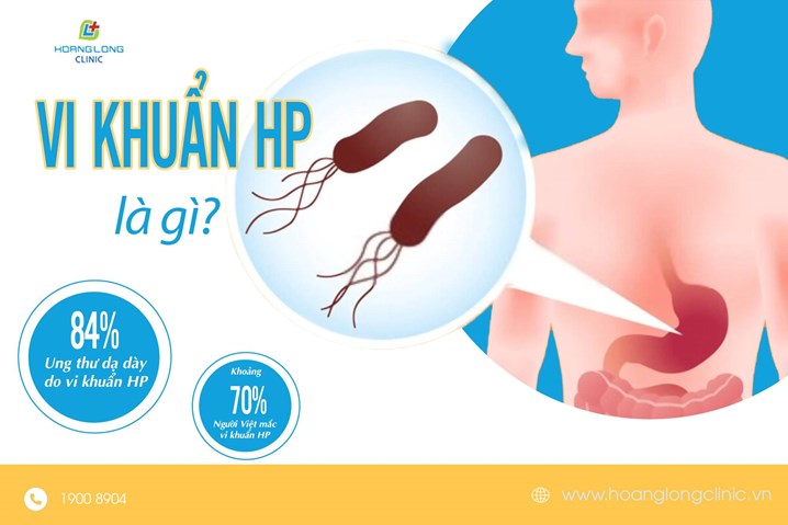 Vi khuẩn HP là gì