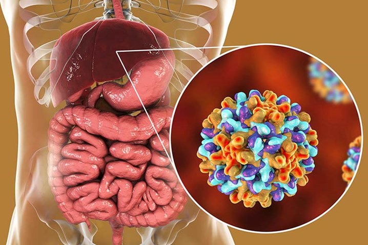 Người bị viêm gan B sống được bao lâu, viêm gan B, virus viêm gan B, viêm gan B cấp, viêm gan B mạn