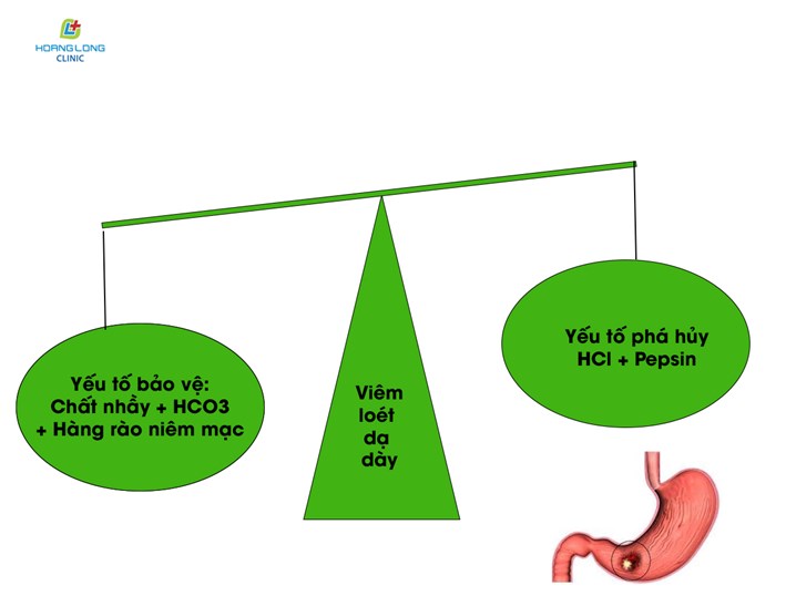 Viêm loét dạ dạ