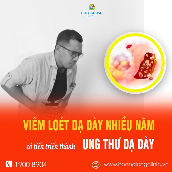 Câu hỏi khá thường gặp viêm loét dạ dày nhiều năm có tiến triển thành ung thư dạ dày?